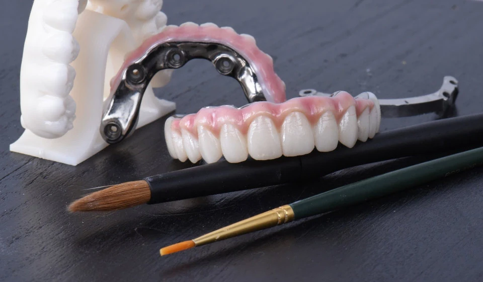 some of the dental restorations offered at Take 2 Dental Implant Studio